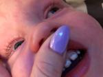Пятна на зубах у ребёнка фото 2