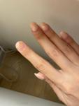Странное пятно на ногте руки фото 1