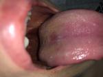 Розовые пятнышки во рту фото 1