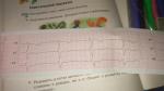 Розшифровка кардиограмы фото 2