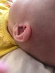 Поломанное ушко у новорождённого фото 1