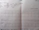 ЭКГ кардиограмма фото 1
