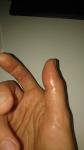 Прибитый палец - сильная боль фото 2