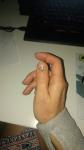 Прибитый палец - сильная боль фото 1