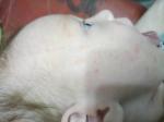 Сыпь на лице у новорожденного фото 2
