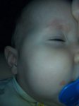 Пятно возле губы у ребёнка 9 месяцев фото 1