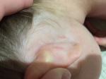 Ногти и кожа за ушком у ребенка фото 2