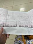 Расшифровка результатов ктг срок 34,4 недели фото 4