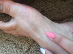 Палец ноги и пятно фото 2