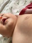 Высыпание на лице и теле у ребёнка 4 месяцев фото 2