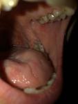 Слизистая рта и горло фото 2