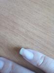 Дискомфорт на ногте фото 1