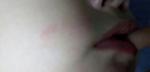 Красные пятна и сыпь у ребенка 2 года на лице фото 2