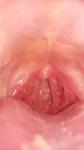 Нужна помощь болит горло больше месяца присутствует температура фото 1