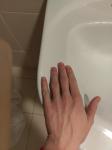 Боли и увеличение суставов фалангов пальцев фото 5