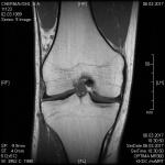 Определение проблемы по МРТ коленного сустава при пересылке по электронке фото 2