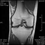 Определение проблемы по МРТ коленного сустава при пересылке по электронке фото 3