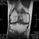 Определение проблемы по МРТ коленного сустава при пересылке по электронке фото 4