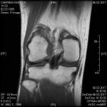 Определение проблемы по МРТ коленного сустава при пересылке по электронке фото 5