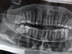 Рентген зубов консультация фото 1
