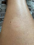 Бело шершавое Пятно на ноге фото 1