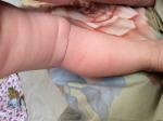 У доченьки 10 месяцев красные пятнах на ножках, которые шелушатся фото 3