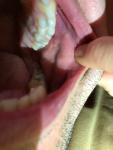 Афтозный стоматит язвы во рту фото 4