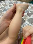 Шершавая кожа на ножках и ручках и ребенка два года фото 1