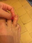 Боль на пальце правой ноги фото 2