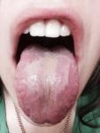 Болит язык! фото 1
