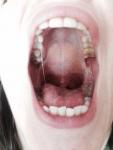 Болит язык! фото 4