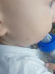 Пятно на щеке у ребенка фото 1