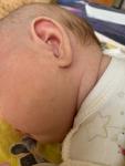 Сыпь на щеках младенца фото 2