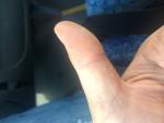 Уплотнения и трещины на пальцах рук фото 4