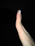 Кривые пальцы с рождения фото 2