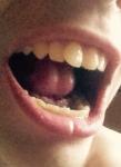 Кривые зубы фото 3