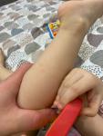Шершавая кожа на ножках и ручках и ребенка два года фото 2