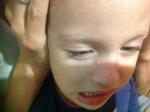 Прыщи на носу у ребёнка 3 лет фото 2