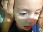 Прыщи на носу у ребёнка 3 лет фото 3