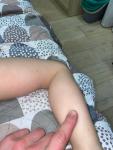 Шершавая кожа на ножках и ручках и ребенка два года фото 4