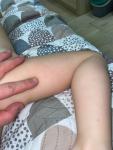 Шершавая кожа на ножках и ручках и ребенка два года фото 5