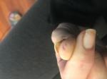Белое пятно на ногте фото 2