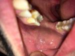 Проблемы в области слизистой рта и глотки фото 1