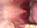 Проблемы в области слизистой рта и глотки фото 4