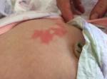 Высыпание на новорожденной не возвышается над кожей, что это? фото 2