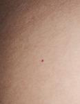 Появились красные точки на теле с зудом фото 4