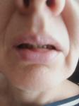 Видна слизистая нижней губы фото 1