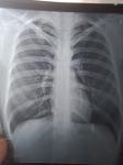 Рентген, флюорография фото 1