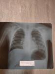Рентген лёгких, описание фото 1