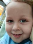 Фиолетовые синяки под глазами у ребёнка 2 лет фото 2